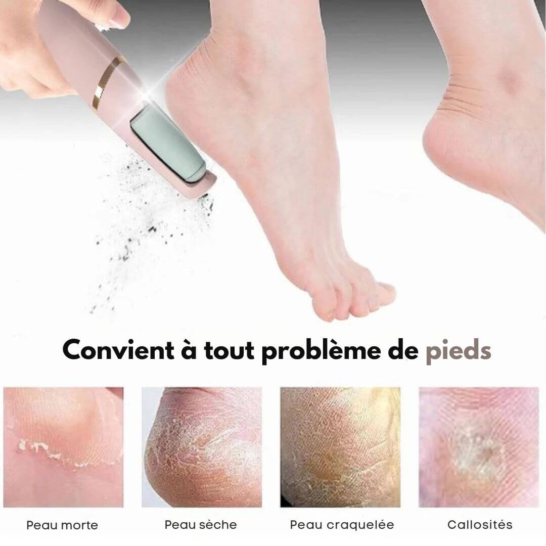 Ponceuse anti-callosité Minnovia™